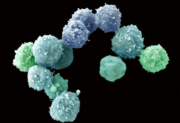 1527470546281062846.jpg alz9-hcaquev2313167.jpg