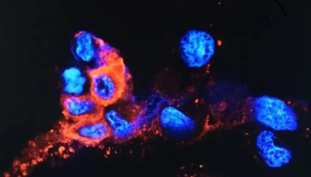 1640143224975099608.png image.png